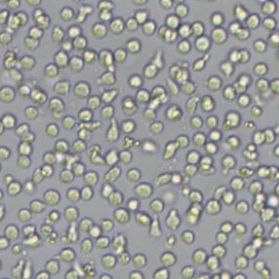 CoC1人卵巢癌细胞(带STR鉴定)