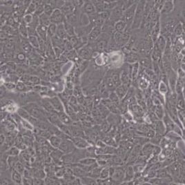 CFPAC-1人胰腺癌细胞(带STR鉴定)