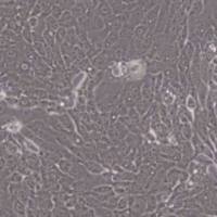 CFPAC-1人胰腺癌细胞(带STR鉴定)