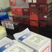 E抗体(Anti-HBe)放免检测