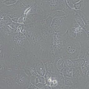 HCC1937人乳腺癌细胞(带STR鉴定)