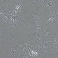 HCC1937人乳腺癌细胞(带STR鉴定)