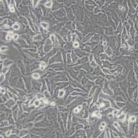 Hela人宫颈癌细胞(带STR鉴定)