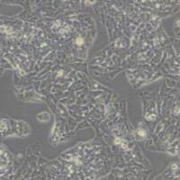 HepG2人肝癌细胞(带STR鉴定)