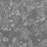 HCT116人结肠癌细胞(带STR鉴定)