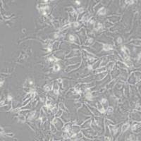 Hep3B2.1-7人肝癌细胞(带STR鉴定)