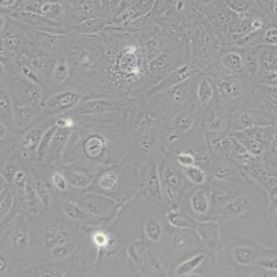 HK2人肾皮质近曲小管上皮细胞(带STR鉴定)