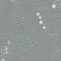 HEC1A人子宫内膜腺癌细胞(带STR鉴定)