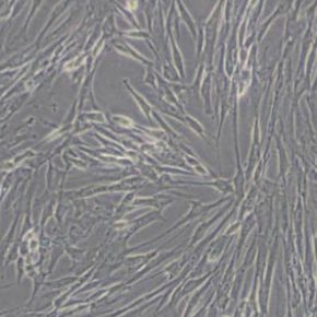 HFL1人胚肺成纤维细胞(带STR鉴定)