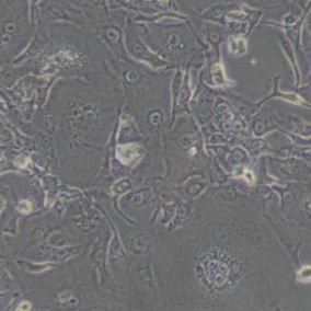 HCCC-9810人胆管细胞型肝癌细胞(带STR鉴定)