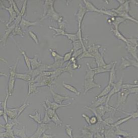 ES2人卵巢透明细胞癌细胞(带STR鉴定)
