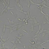 ES2人卵巢透明细胞癌细胞(带STR鉴定)