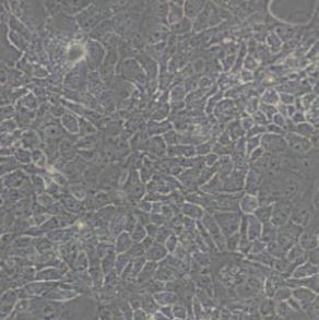 HCC827人非小细胞肺癌细胞(带STR鉴定)