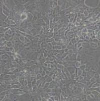 HCC827人非小细胞肺癌细胞(带STR鉴定)