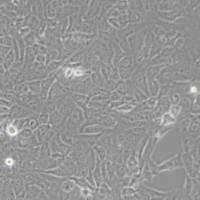 HT-1080 [HT1080]人纤维肉瘤细胞(带STR鉴定)