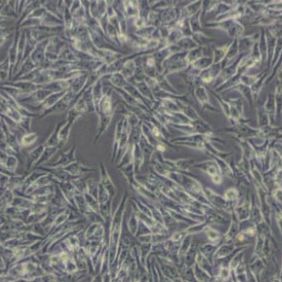 HGC27人胃癌细胞(未分化)(带STR鉴定)