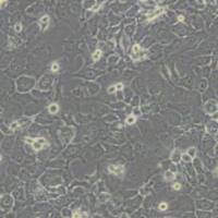 FaDu人咽鳞癌细胞(带STR鉴定)