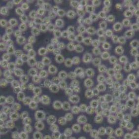 HL60人原髓细胞白血病细胞(带STR鉴定)