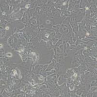 HCT-8 [HRT-18]人回盲肠癌细胞(带STR鉴定)