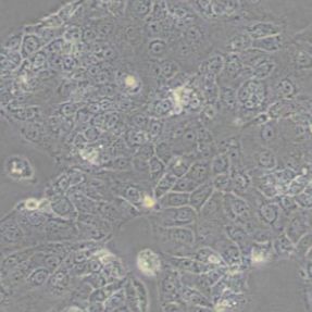 HuH6人肝母细胞瘤细胞(带STR鉴定)