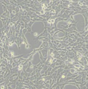 HBL-100人整合SV40基因的乳腺上皮细胞(带STR鉴定)