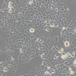 HEC1B人子宫内膜腺癌细胞(带STR鉴定)