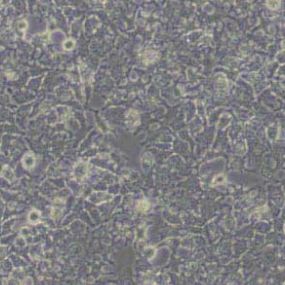 HuH-7人肝癌细胞(带STR鉴定)
