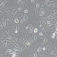 GBC-SD人胆囊癌细胞(带STR鉴定)