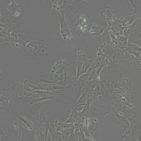 Hs578T人乳腺癌细胞(带STR鉴定)