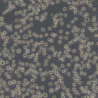 KG1人急性骨髓性白血病细胞(带STR鉴定)