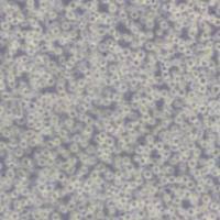 NAMALWA(人Burkitt's淋巴瘤细胞)带STR鉴定