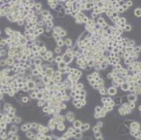 MDA-MB-453人乳腺癌细胞(带STR鉴定)