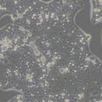 NCI-N87人胃癌细胞(带STR鉴定)