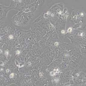 JEG3人绒毛膜癌细胞（带STR鉴定）