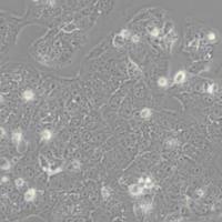 JEG3人绒毛膜癌细胞（带STR鉴定）