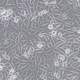 MGC803人胃癌细胞(带STR鉴定)