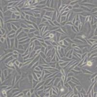 SiHa人子宫颈鳞癌细胞(带STR鉴定)