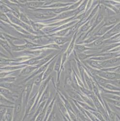 MG63人骨肉瘤细胞(带STR鉴定)