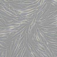 MG63人骨肉瘤细胞(带STR鉴定)