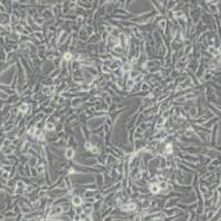 RD人恶性胚胎横纹肌瘤细胞(带STR鉴定)