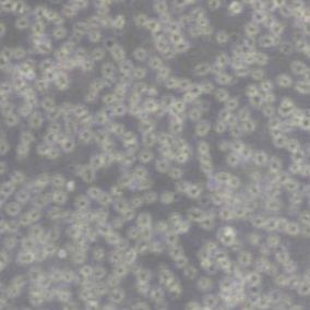 JeKo1人套细胞淋巴瘤细胞(带STR鉴定)