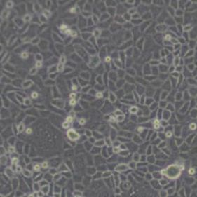 ME180人子宫颈表皮癌细胞(带STR鉴定)