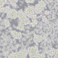 Raji(人Burkitt's淋巴瘤细胞)(带STR鉴定)