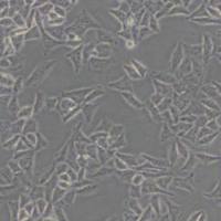 QGY7701人肝癌细胞（带STR鉴定）