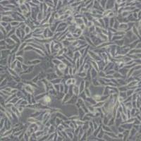 RKO人结肠腺癌细胞(带STR鉴定)