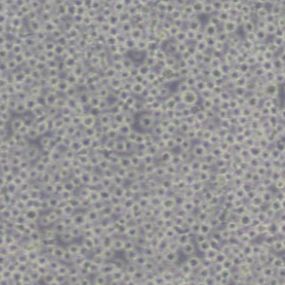 K562人慢性髓原白血病细胞(带STR鉴定)
