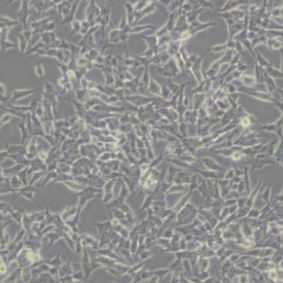 SHSY5Y人神经母细胞瘤细胞(带STR鉴定)