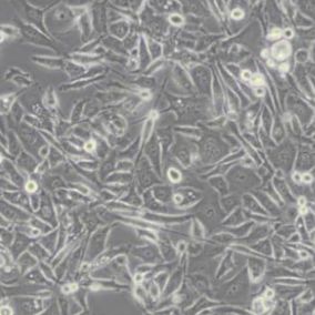 PC3人前列腺癌细胞(带STR鉴定)