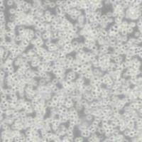 MOLT4人急性淋巴母细胞白血病细胞(带STR鉴定)