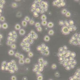 Jurkat, Clone E6-1人T淋巴细胞白血病细胞(带STR鉴定)